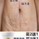 速发去除妊娠纹修复霜产后消除祛肥胖妊辰生长纹紧致孕妇专用预防