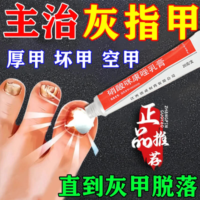 【扬子洲】硝酸咪康唑乳膏2%*20g*1支/盒