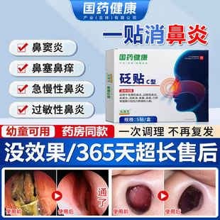 国药健康礼医生鼻炎砭贴过敏性急慢性鼻窦炎剂流鼻涕鼻塞鼻痒MM6