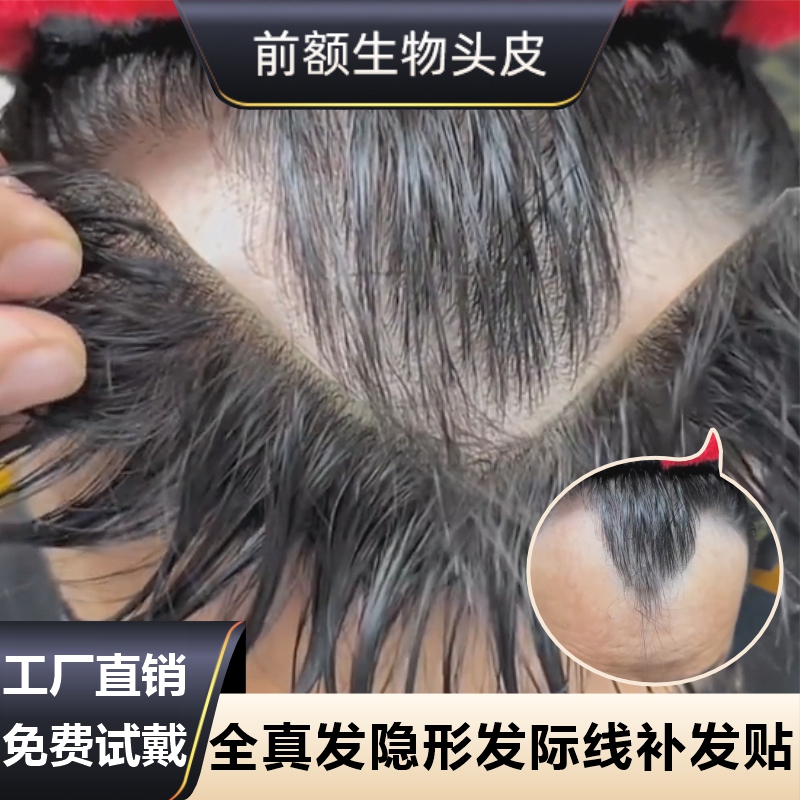 速发发际线假发假假刘海贴发片m形发际线贴男一片式前额补发自然
