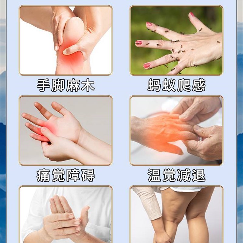 腕管综合症手麻腕管综合症手麻治手麻四肢N麻木的膏药贴腕管综
