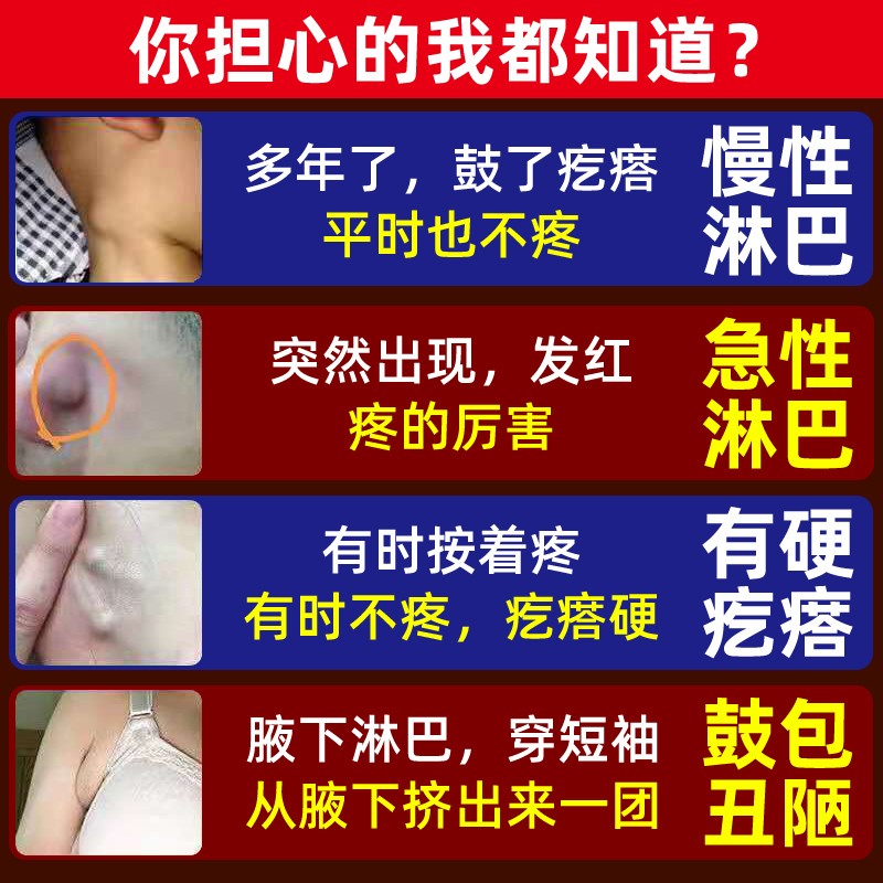 极速淋巴结肿大散结贴膏【不w开刀不手术】专消颈部腋下淋巴结节