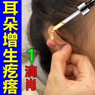 极速耳洞疙瘩增生耳洞发炎护理液耳朵痒耳洞流脓过敏消Y炎专用清