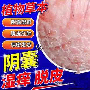 阴囊瘙痒湿疹止痒私处睾丸痒脱皮潮湿去真菌感染可搭配膏药贴BX
