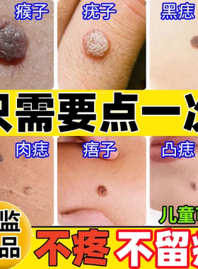 点痣膏无痕正品旗舰店祛痣药水不留疤点痣点斑去痦子专用修护液pk