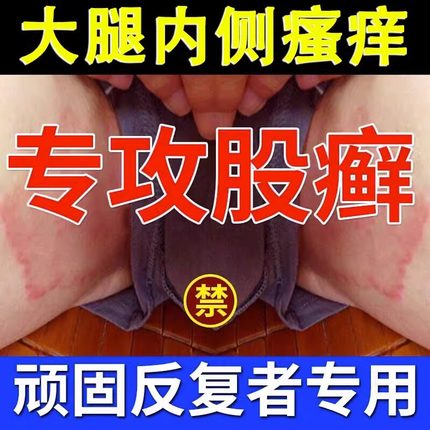股藓大腿内侧根皮肤瘙痒真菌感染牛皮癣药体股癣去湿疹屁股止痒膏