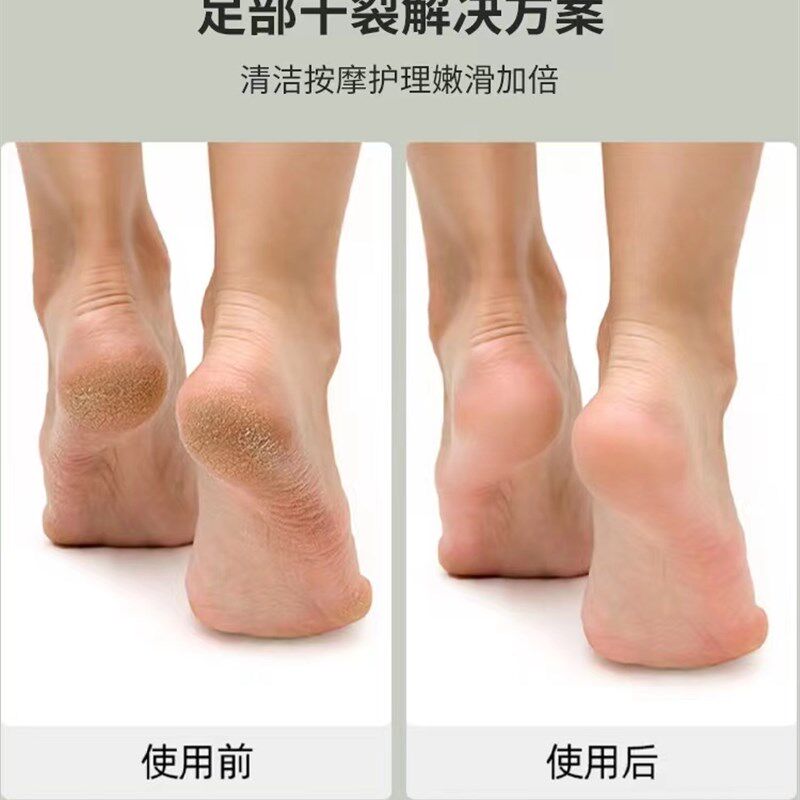 新品电动充电自动去老q茧磨脚神器去死皮修足机修脚器足部磨皮