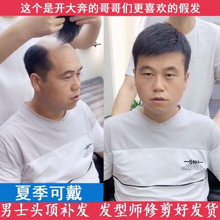 新品假发男短发头顶补发片男士假发帅气韩版男隐S形无痕秃顶地中
