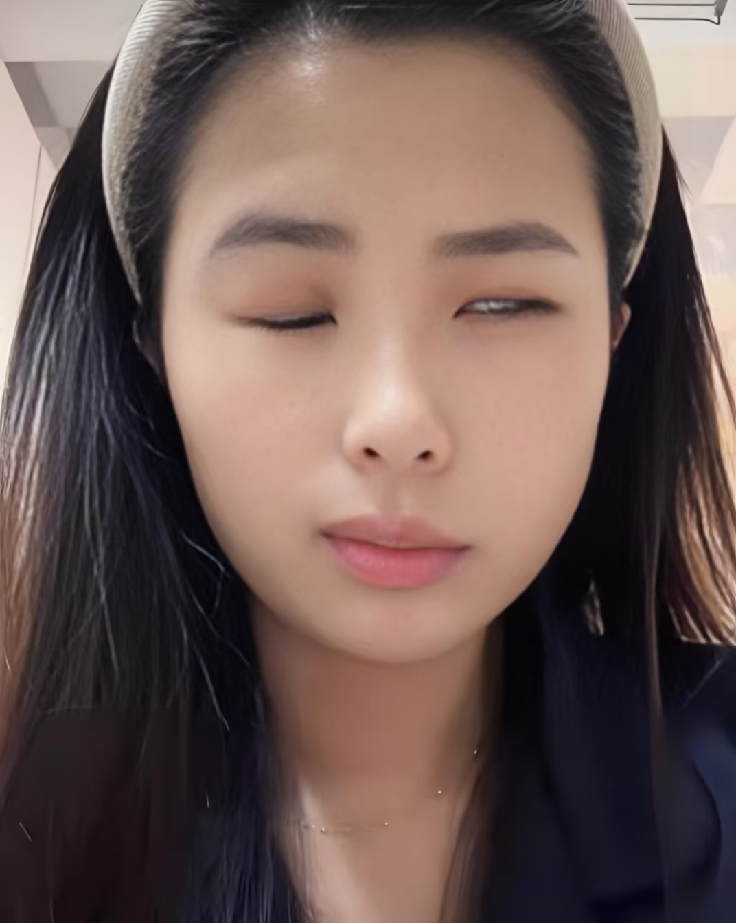 面瘫贴牵正膏后遗症脸部热敷恢复专用药歪抬不起眉口眼训练器神器