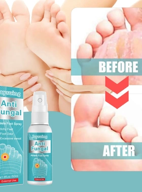 Athlete Foot Spray Smelly Feet Itchy Sweaty Rotten Feet Spra