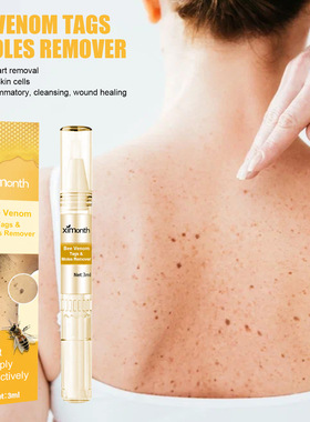 Keyou liquid pen skin Keyou eliminate nevus nevus meat nevus