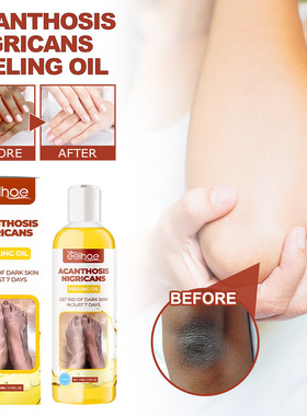 Exfoliating oil of acanthus nigricans, whitening and brighte