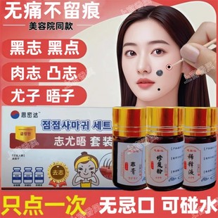 点痣膏脸部无痕药水旗舰店正品去黑点黑痣点祛痦子取痣不留疤专用