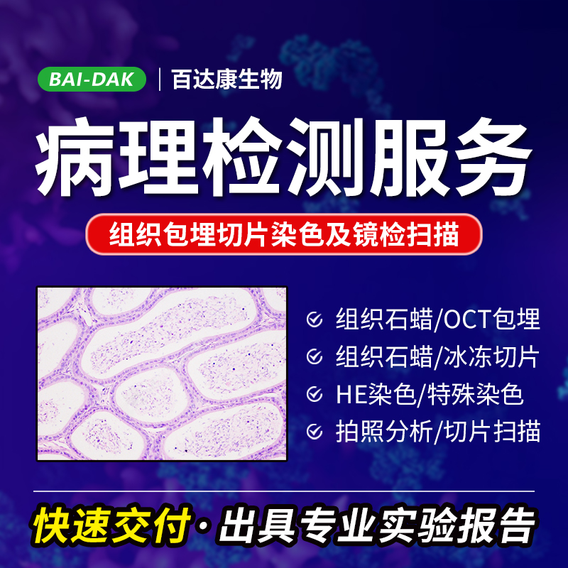 组织标本做包埋切片 HE染色 镜检