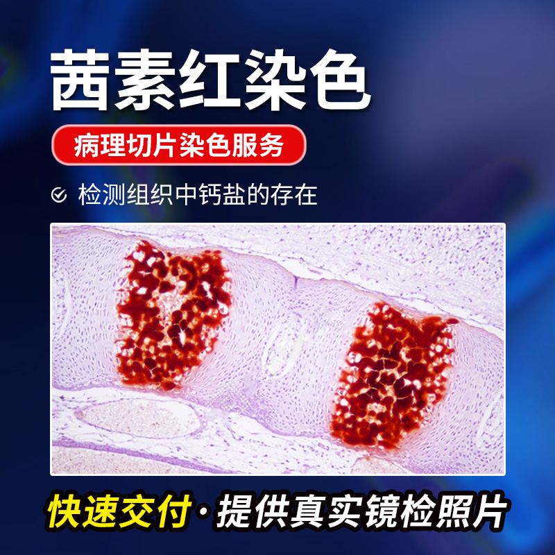 茜素红染色病理切片特殊染色