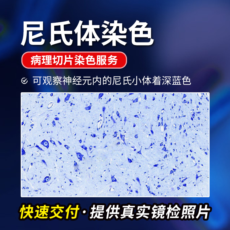 尼氏染色神经元尼氏小体