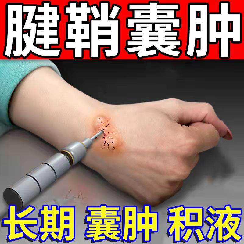 腱鞘炎贴膏手腕手指腱鞘囊肿鼓包痛舒专用贴膏药贴舒筋贴mz