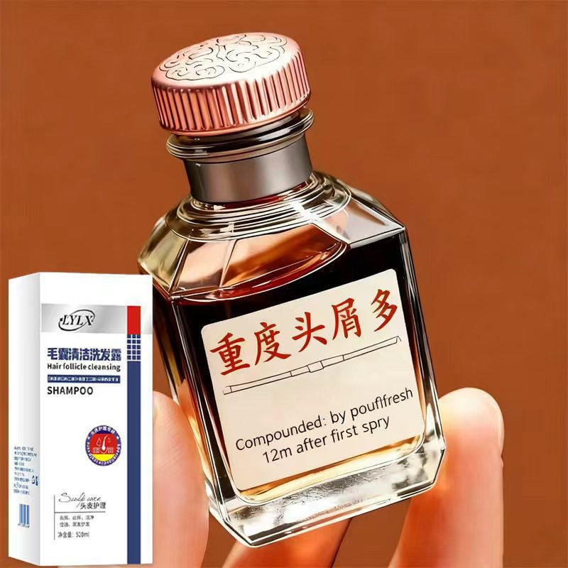 去屑洗发水毛囊控油止痒头皮清洁蓬松炎头膏男女官方正品牌洗发露
