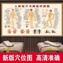 人体经络穴位标准大图艾灸推拿中医养生馆高清海报墙贴自粘画挂图