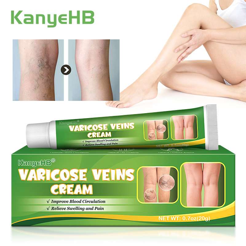 KanyeHB脉康膏静脉膏蚯蚓腿脉管液wishtemu