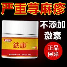 寻荨麻疹过敏止痒断专用治胆碱急慢性高免疫力皮肤瘙痒药膏