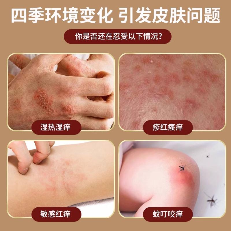 辅世汉方正品官方旗舰店一抹灵抑菌乳膏皮肤外用膏一抹灵抑菌乳膏