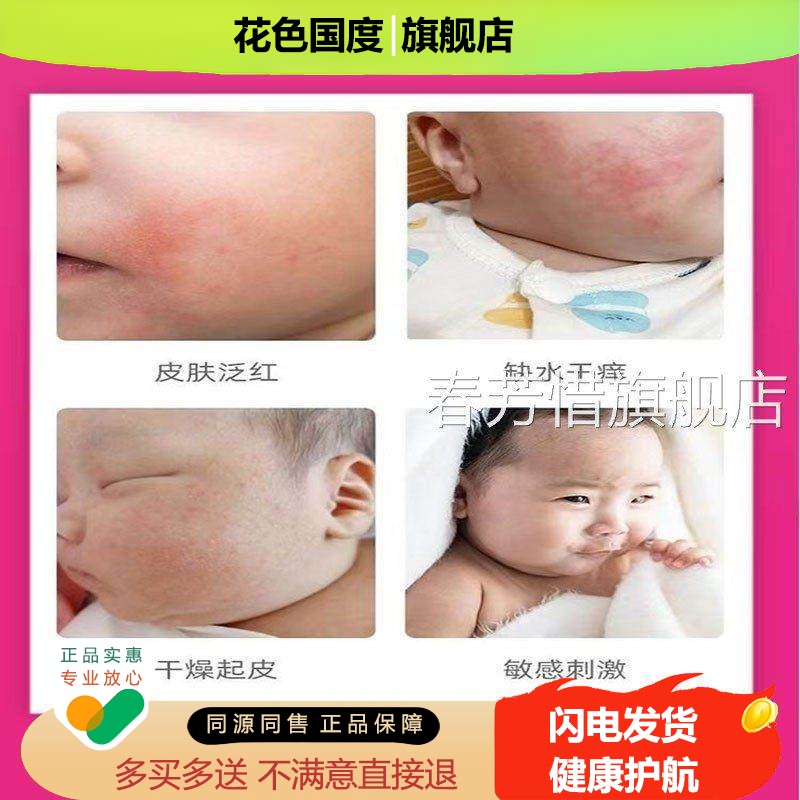 皮崔恩贝炉甘石宝宝抑菌膏部痒潮红脸脱私处红屁屁奶淹脖子