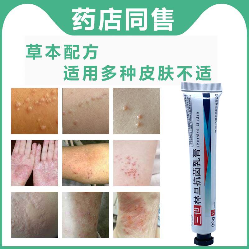 3支30元 三世林旦乳膏林蛋软膏乳膏阴虱林旦软膏男女皮肤外用正品