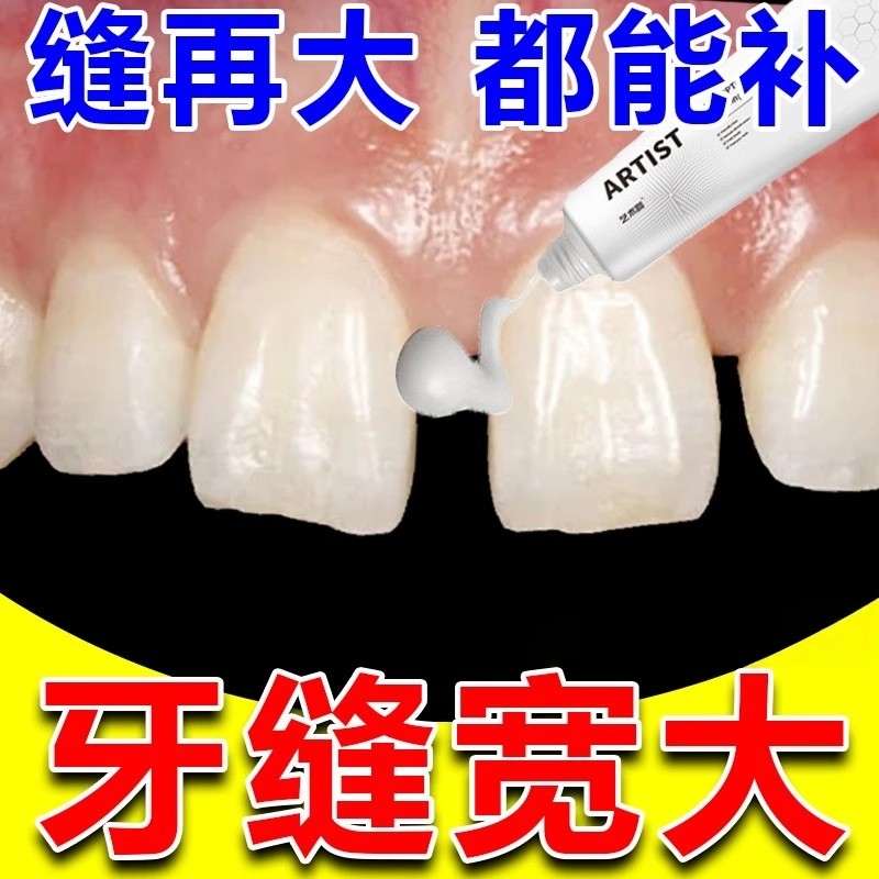 牙齿缝隙填充剂矫正门牙牙缝宽大修复神器松动吃饭塞牙龈萎缩牙膏