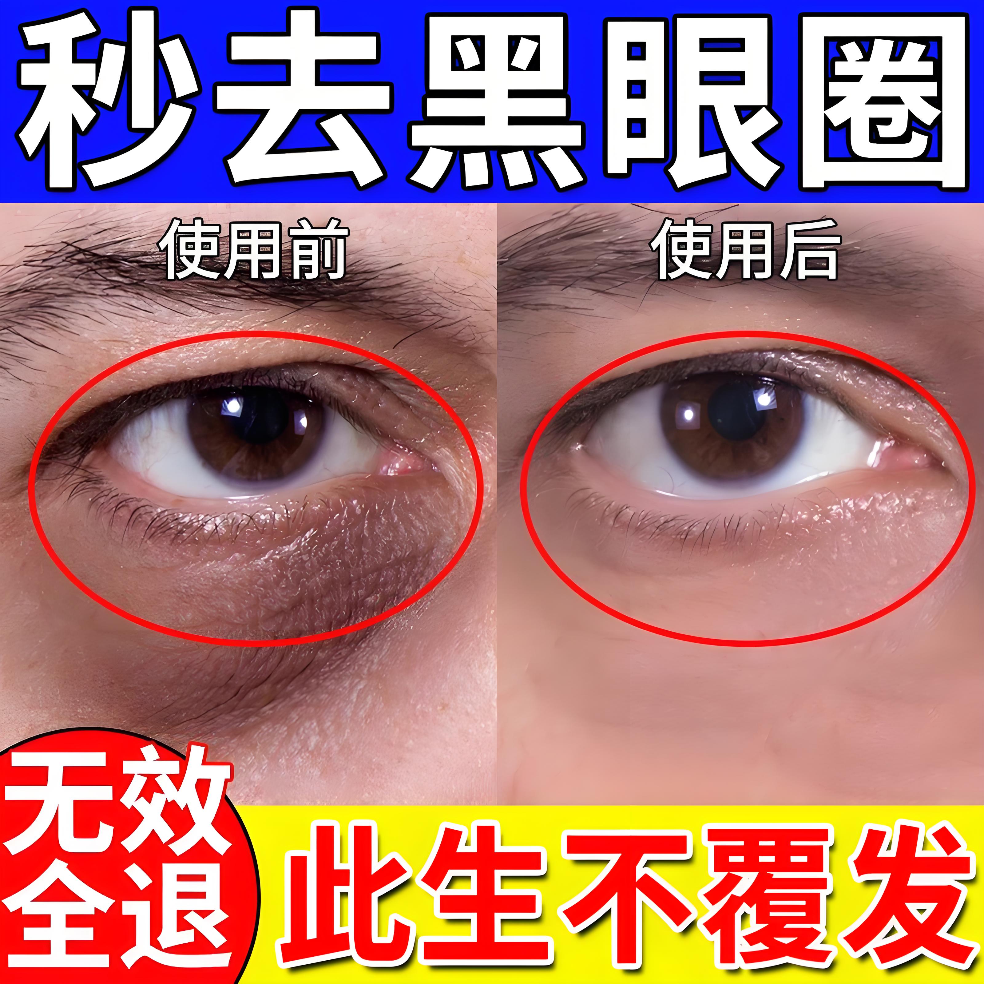 眼疲劳黑眼圈900%包治好】同仁堂