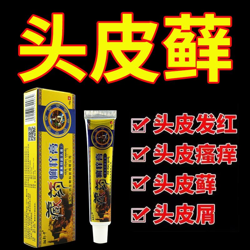 药膏治头部有疙瘩发红发痒头皮屑严重银屑癣顽固性皮癣真