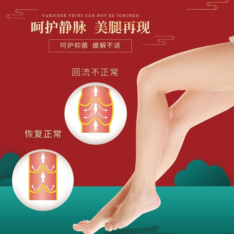 药膏青筋凸起精索曲张蚯蚓腿上红血丝静脉舒