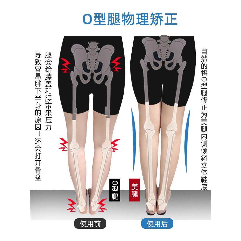 鞋底外侧磨损足内外翻矫正器罗圈腿脚后跟xo型小腿外翻校正鞋垫