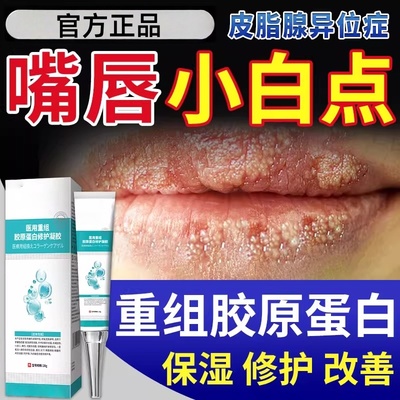 皮脂腺异位症嘴唇起白点脂肪小颗粒疱疹膏专用干裂脱皮增生唇炎