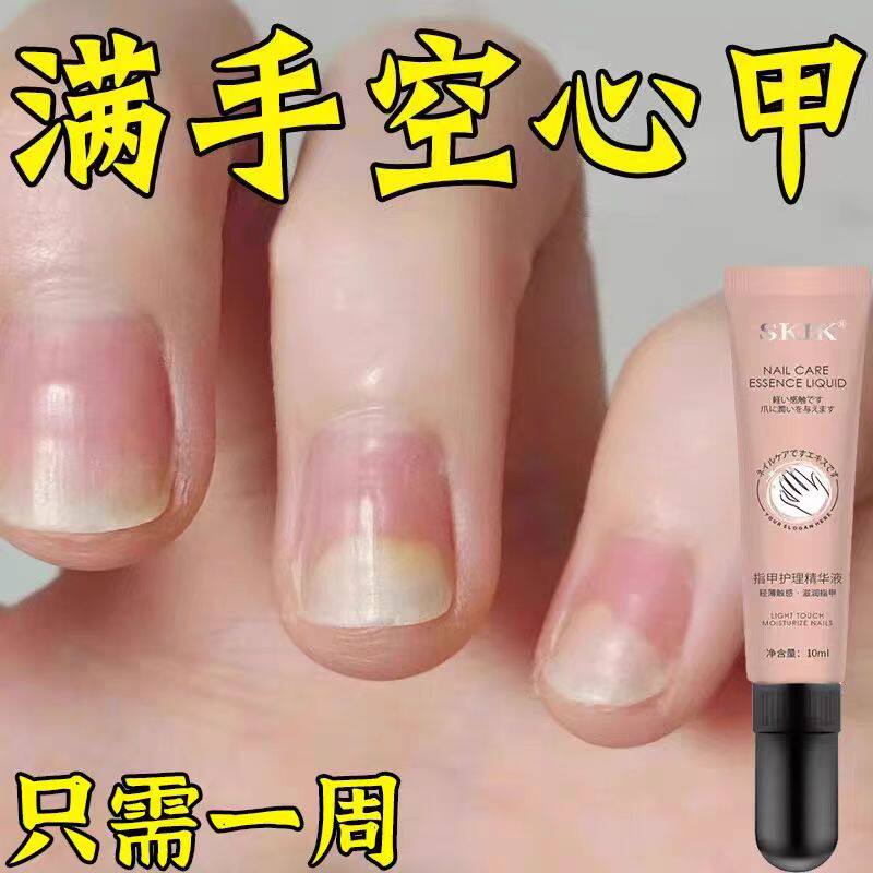 【养出自然真指甲】指甲营养液油增长液修护甲床增厚竖纹防断KJ