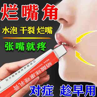 口角炎药膏维生素b6烂嘴角真菌感染上火嘴起泡抗菌抑菌嘴唇疱疹