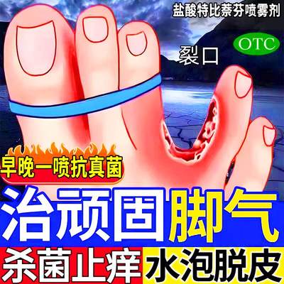 治脚气专用药水泡脱皮止痒杀菌烂脚丫痒脚趾缝糜烂型治疗真菌感染