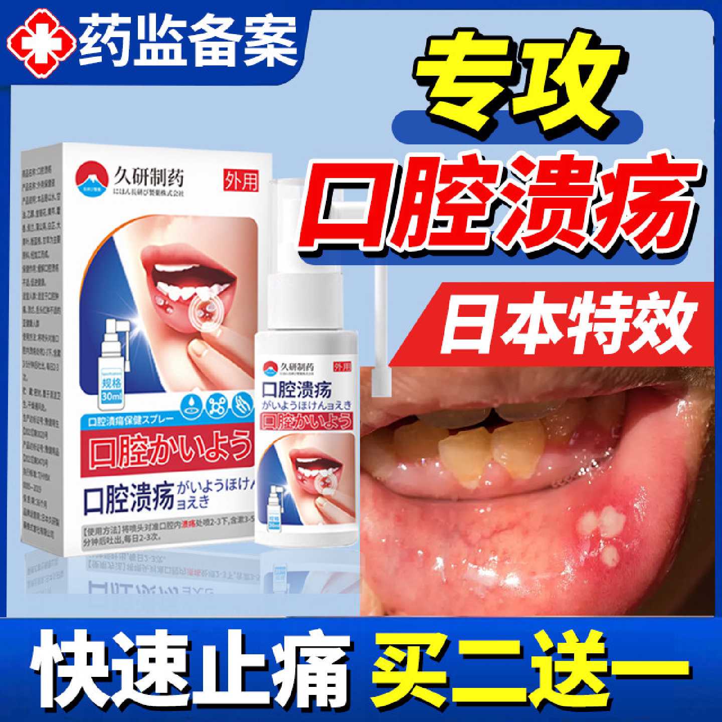日本口腔溃疡修复液喷雾喷剂凝胶一点灵药膏溃疡嘴巴起泡口腔旗舰