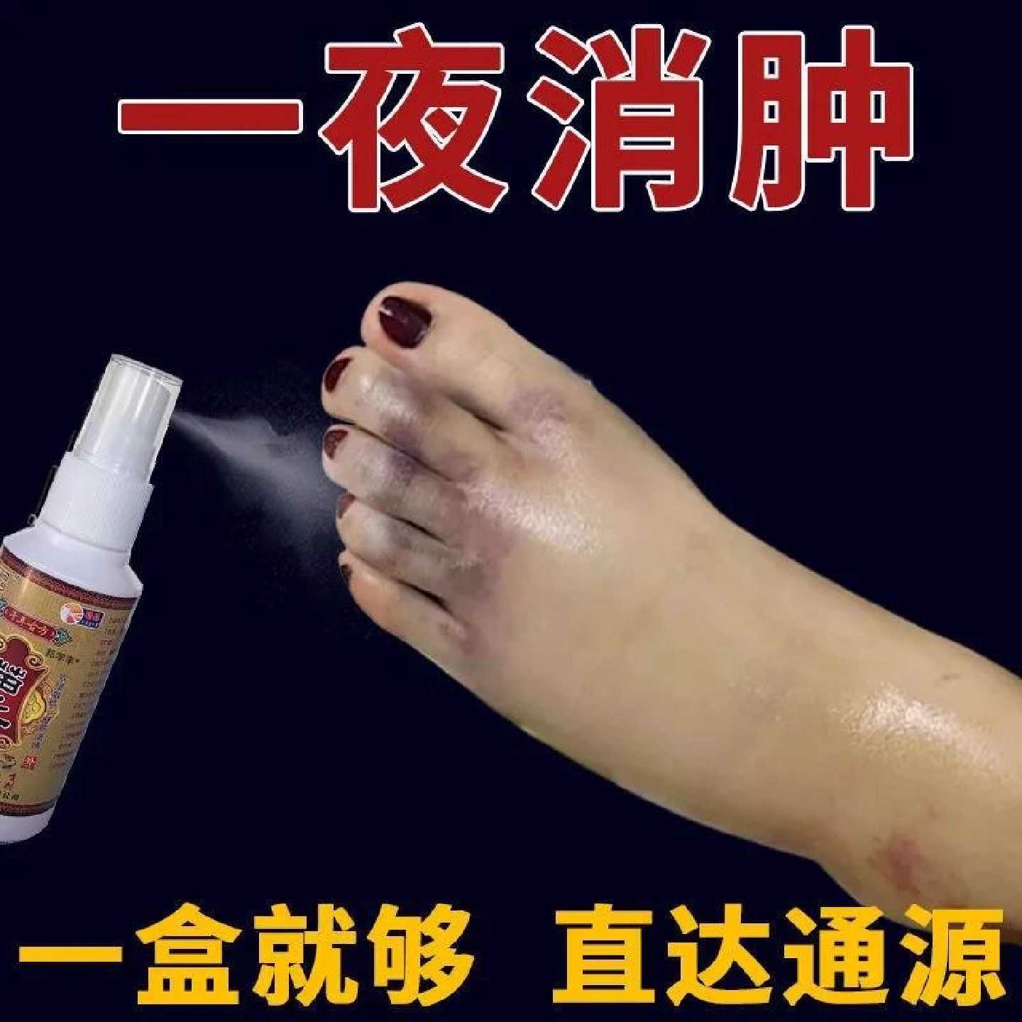 去水肿消特效的药老人脚肿消肿的药消肿止痛喷剂活血化瘀外用旗舰