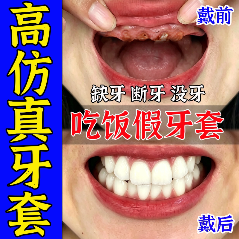 牙套通用吃饭神器万成人能仿真假牙齿全口老年人门牙永遮丑久专用