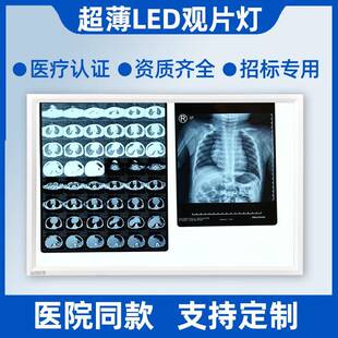 医院LED观片阅片看片灯箱牙科骨科轻薄遥控调光X光观片灯三双联款