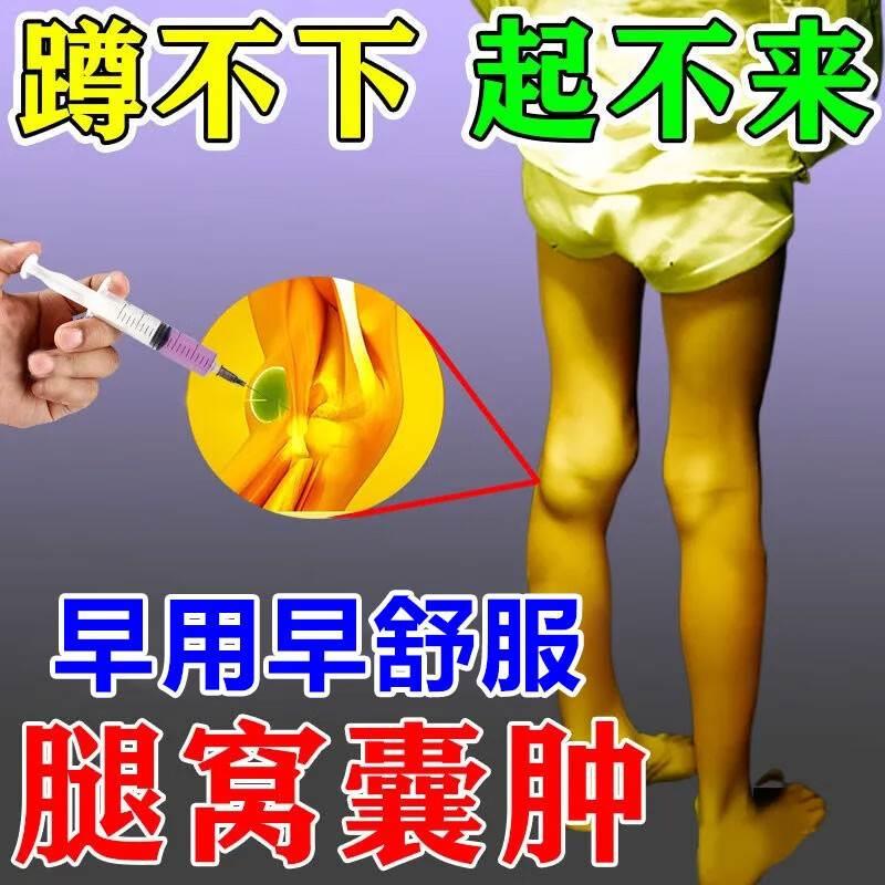 腘窝囊肿贴腿鼓包膝盖后窝筋疼鼓包疼痛伸屈困难关节积液药膏国 医疗器械 膏药贴（器械） 原图主图