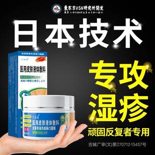 日本皮肤湿疹膏止痒药膏肛周瘙痒水泡皮炎牛皮股癣汗疱疹膏