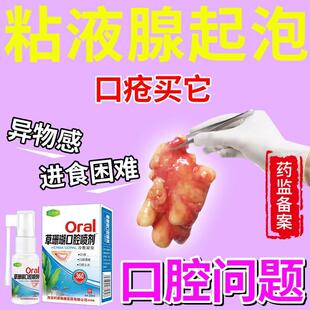 粘液腺囊肿舌下腺囊肿消口腔溃疡Z用药膏进食困难修异物感复喷剂