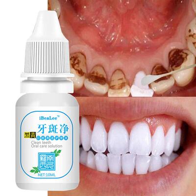 Teeth Whitening Serum Cleans Mouth Freshens Breath