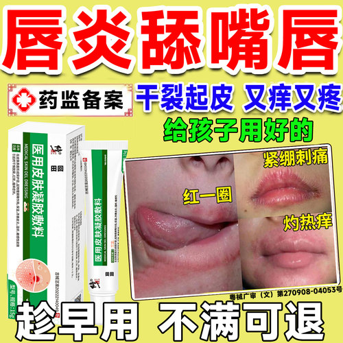 儿童唇炎唇膏嘴唇防干裂脱皮专医用型唇膏凝胶口周出血疼痛皮炎LT