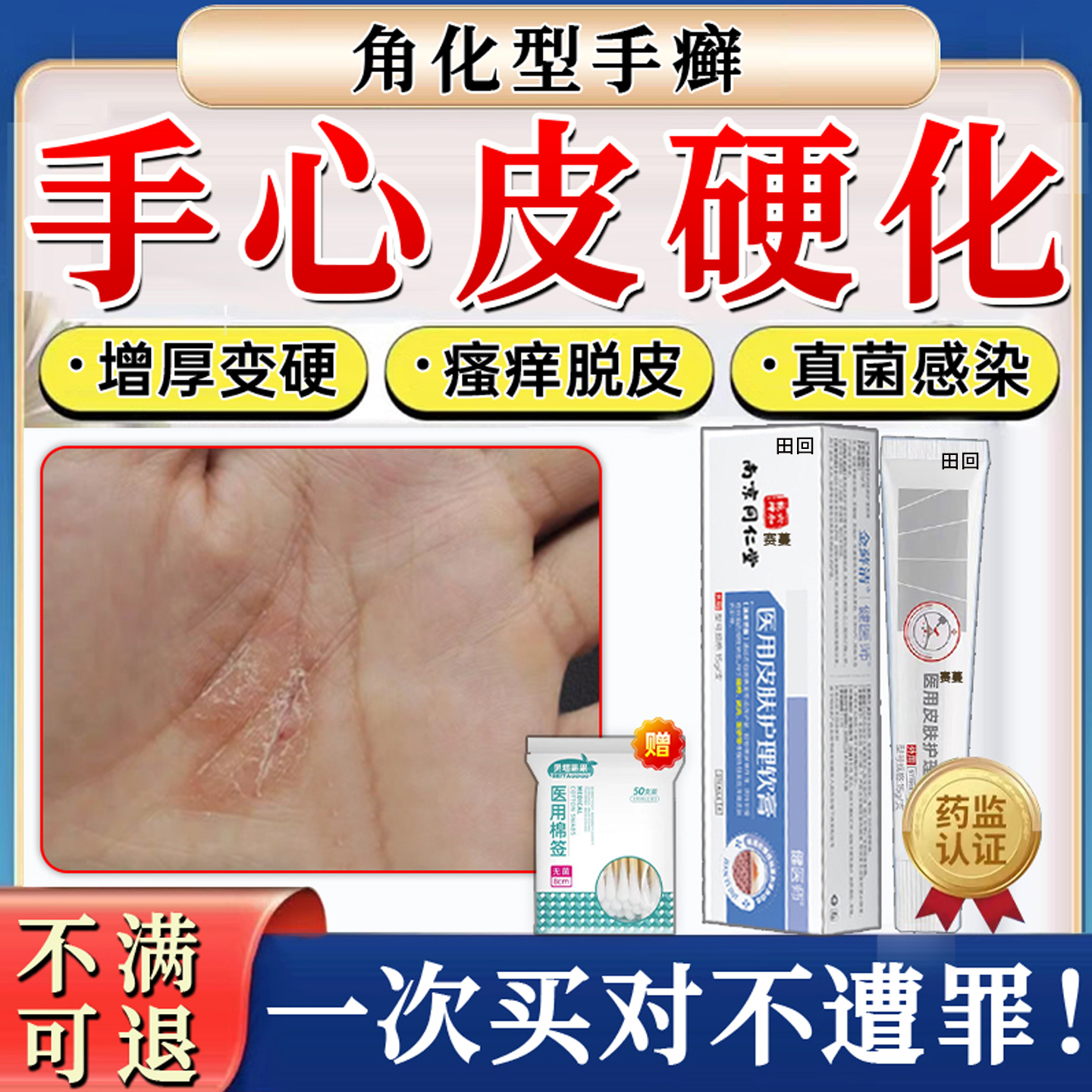 手心黄硬皮增厚角质手癣膏专用脱皮干裂真菌感染鹅掌风手癣膏药TT