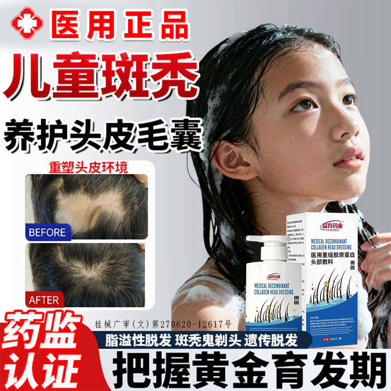 儿童脱斑秃专用洗发发水鬼剃头遮盖特生发液效防脱膏药治疗神器GX