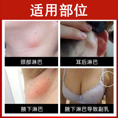 淋巴结肿大散结贴膏耳後颈部腋下淋巴疏通硬块膏去淋巴神器XA