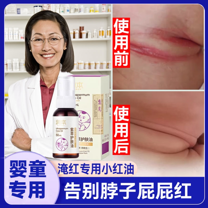 抚触油新生专用宝宝淹脖子小红油夏天婴儿脖子腋下防淹神器紫草油